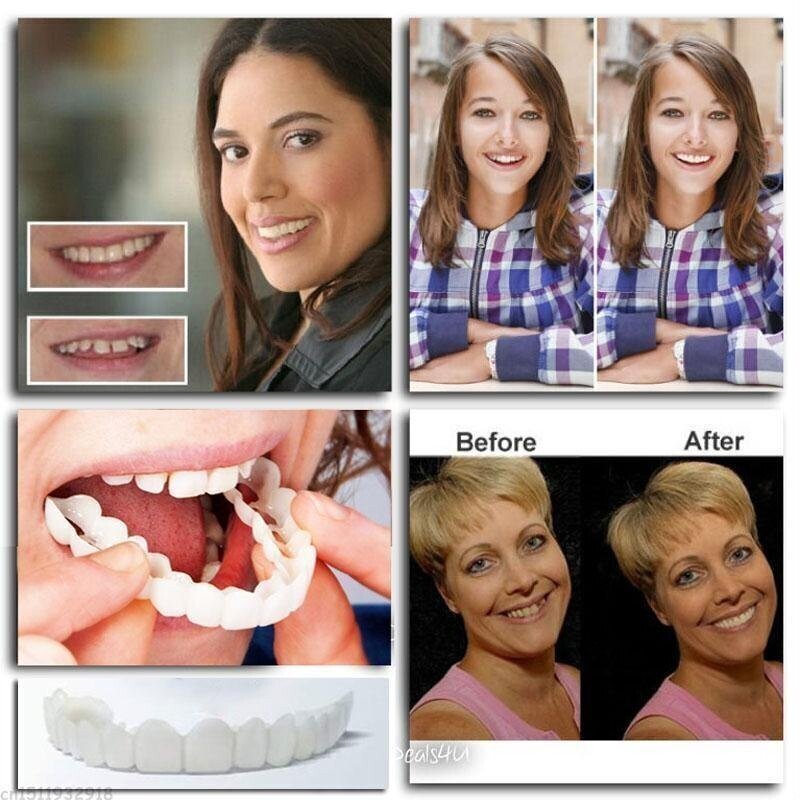 Teeth Denture  (PACK OF 2)